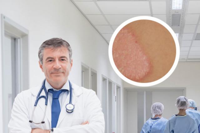 湿疹和皮肤癣哪个更难治愈
