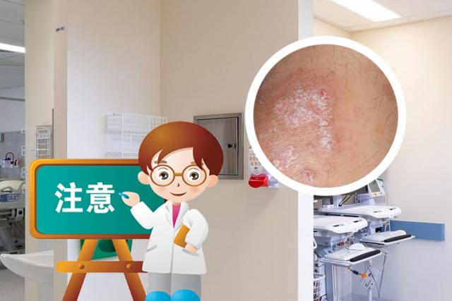 银屑病能喝维生素c泡腾片吗