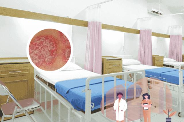 银屑病怎么治疗能治疗好