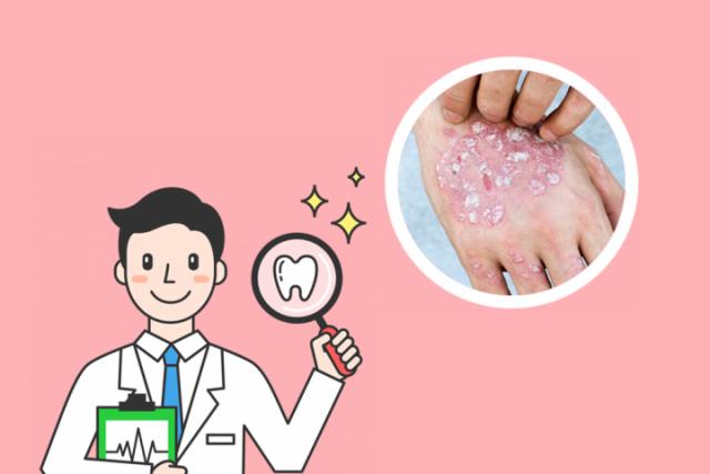 银屑病痒的原因