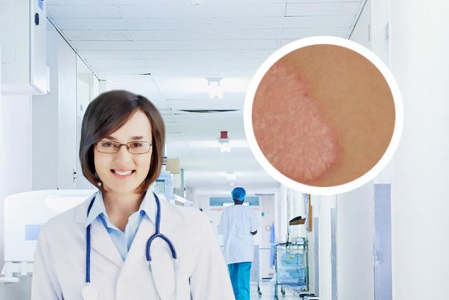怎么区分银屑病和干性湿疹

