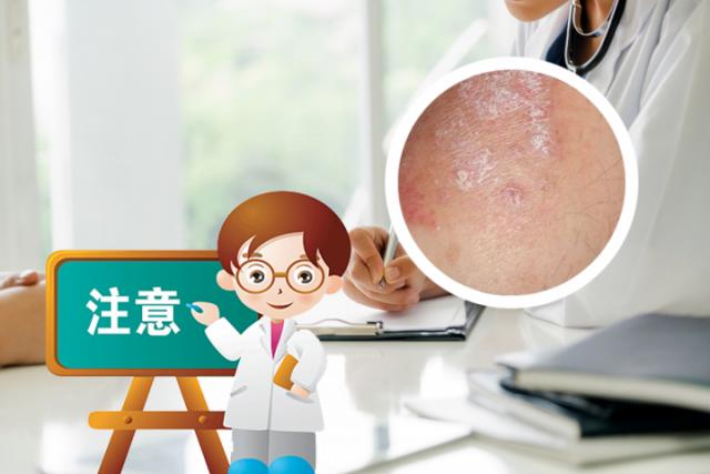 接触银屑病人会传染吗
