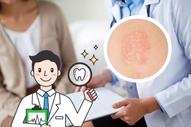 银屑病中药治疗