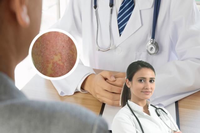 100种皮肤病对照表湿疹图片
