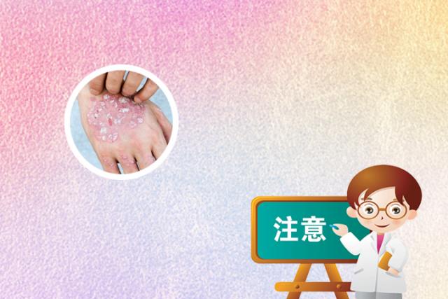 银屑病好了有黑印怎么办
