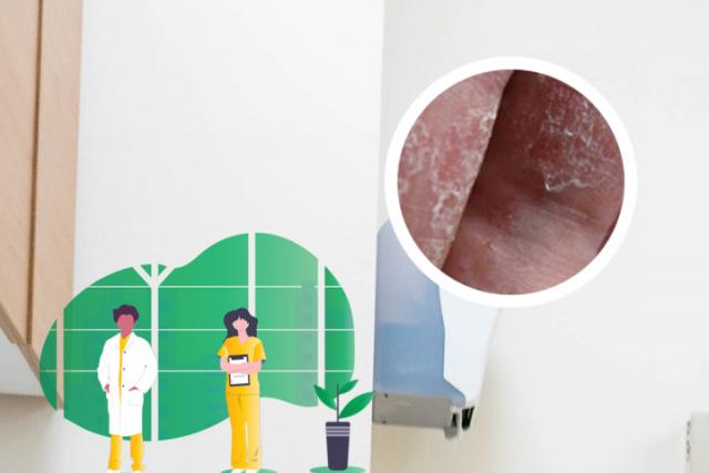 银屑病痊愈留下的黑印