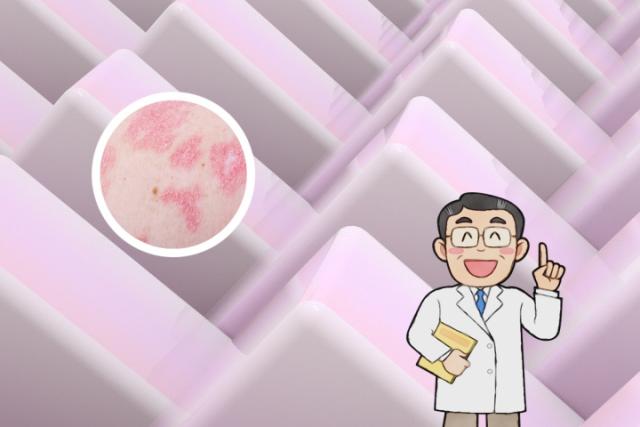 三七粉能治牛皮癣吗