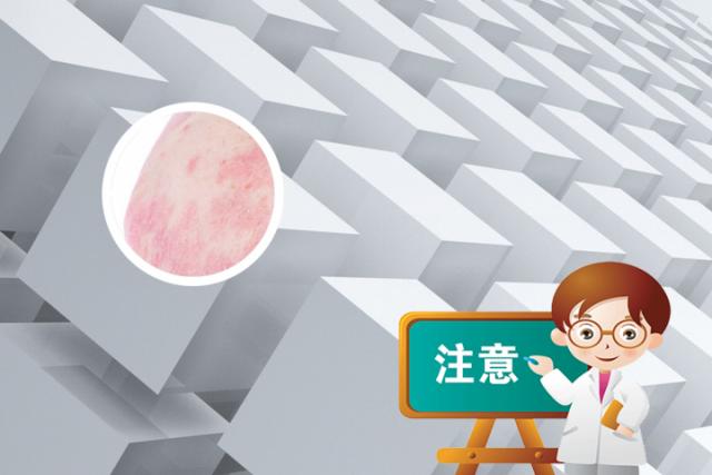 脚背长癣用什么药最好
