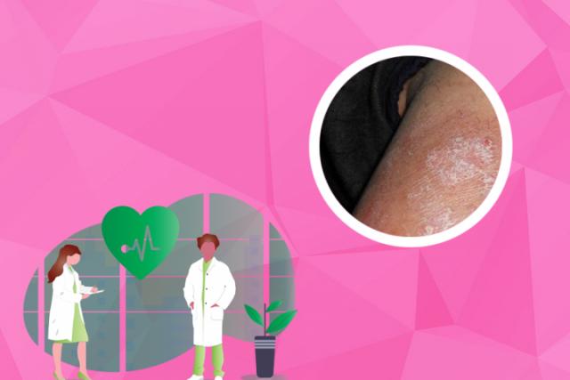 免疫力低下皮肤病湿疹
