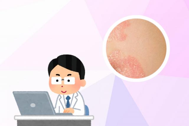 体癣可以根治吗