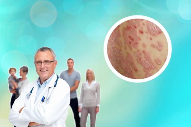 皮炎和湿疹的区别图片