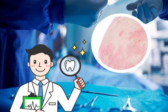 点滴型银屑病用什么药膏

