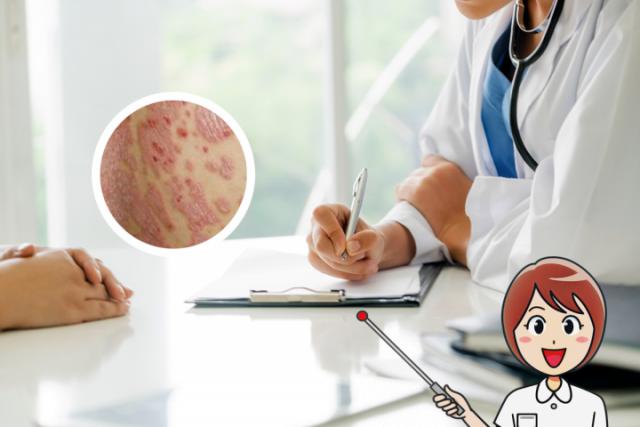 银屑病是什么原因引起的