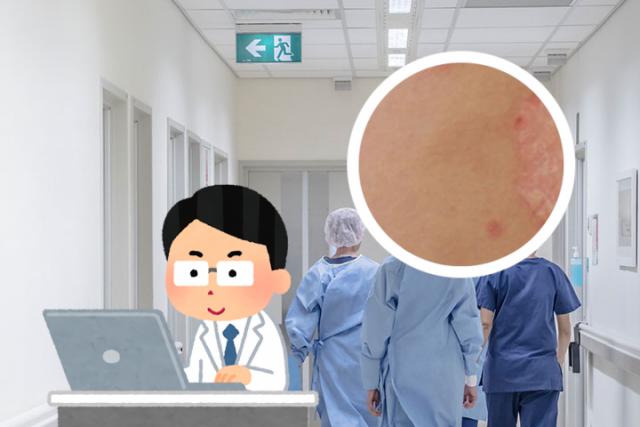 牛皮癣自己好了怎么回事
