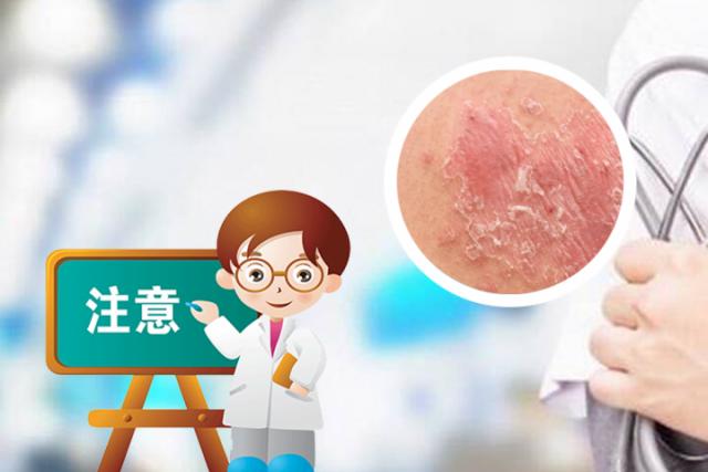 生物制剂治疗皮肤病副作用

