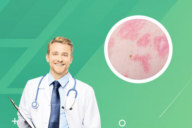 皮炎和湿疹的区别图片