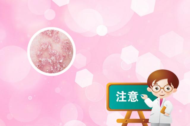 牛皮癣患者能吃枣吗(牛皮癣患者能吃红干枣吗)