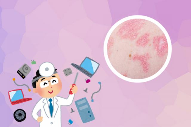 银屑病患者可以吃西葫芦吗
