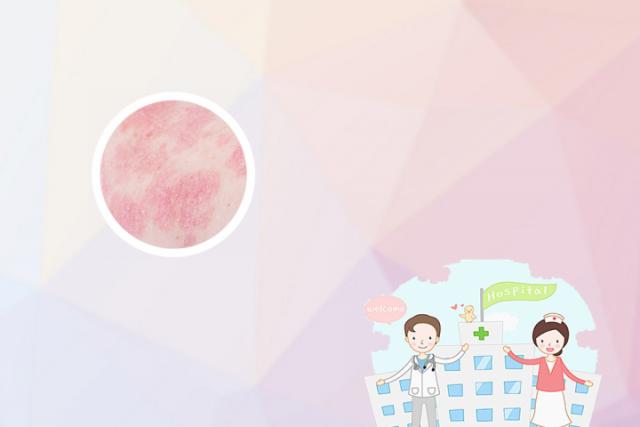 癣用盐擦会好吗
