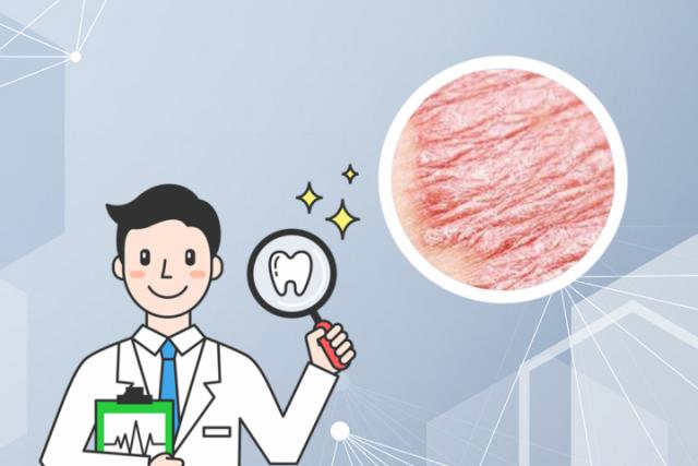 牛皮癣再次复发会扩大吗(银屑病再次复发会扩大吗)